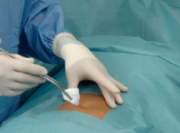 54_hartmann_basis_set_ambu_481x355_z1