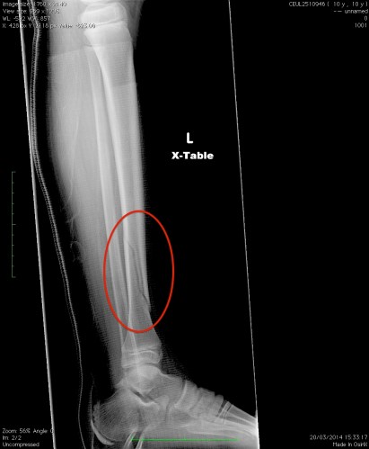 Do you see the problem?